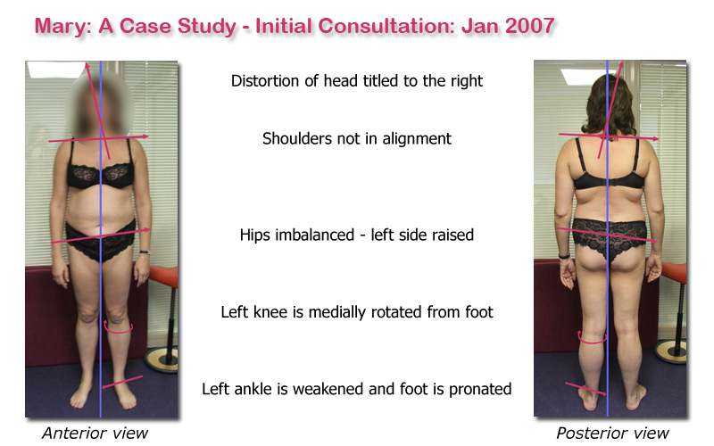 Therapist Surrey workstation assessment